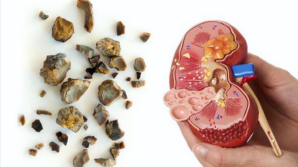 最新化疗药物突破与创新，重塑抗癌之路的希望之光