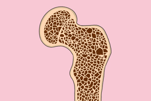 最新型骨癌,揭示疾病与友情的交织力量